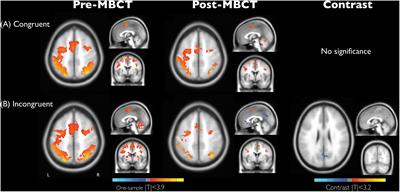 Mindfulness Improves Emotion Regulation and Executive Control on Bereaved Individuals: An fMRI Study